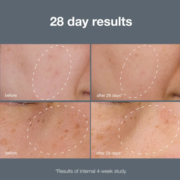 Powerbright Dark Spot System - Image 3